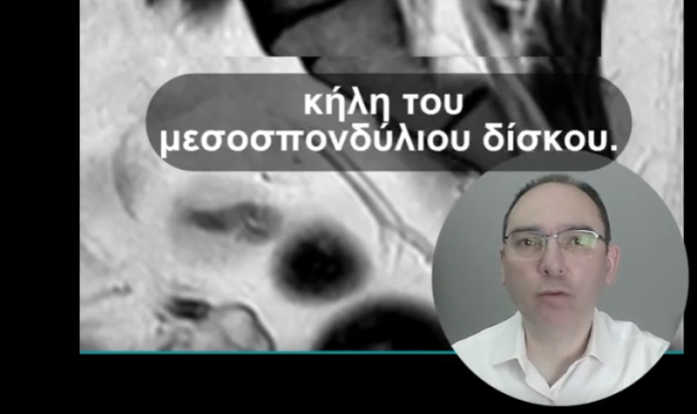 Σέρρες, Διαγνωστικά Εργαστήρια Δημόκριτος: Μήπως ο πόνος στη μέση σου επιμένει; Δες τι συμβαίνει πραγματικά – Μιλά ο ακτινολόγος, Νίκος Πανταζής (ΒΙΝΤΕΟ)